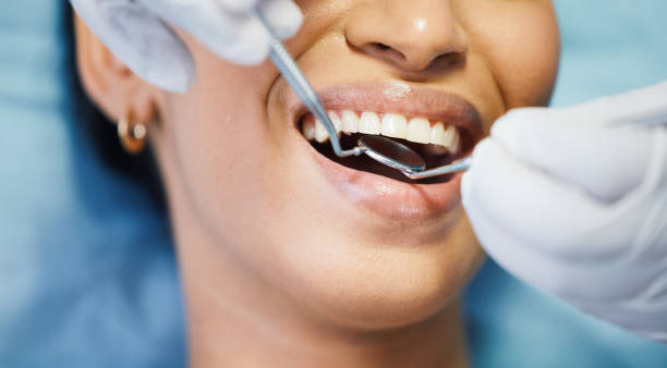 Best Emergency Dentist for Knocked-Out Tooth in Kings Mountain, NC