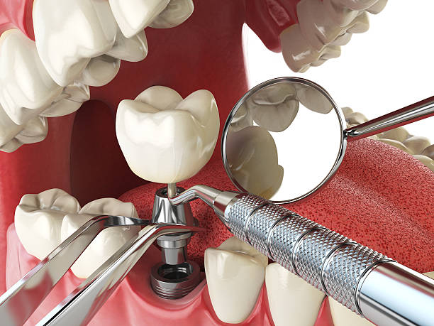 Best Orthodontic Emergency Dentist in Kings Mountain, NC